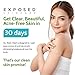 Exposed Skin Care, Body Acne Wash with Salicylic Acid, Glycolic Acid and Tea Tree Oil – Tri-Powered Gentle Exfoliating Cleanser for Back, Chest and Body Acne – Natural, Non-toxic and Cruelty Free