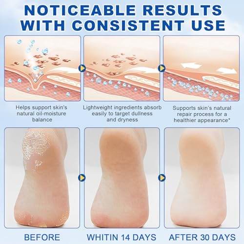 60% Urea Foot Care Stick with 2% Salicylic Acid, 2-Pack Moisturizing Foot Cream Stick for Dry Cracked Heels, Calluses, Rough Thick Skin, Feet, Hands, Elbows & Knees