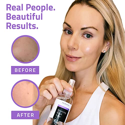 Balancing Facial Toner Spray With Chamomile, Hydrating Toner For Face Wrinkles, Pore, Dull Skin & Dark Spot, Anti Aging Skin Toner, Face Toner For Women & Men, Face Toner By Yeouth #TOP4