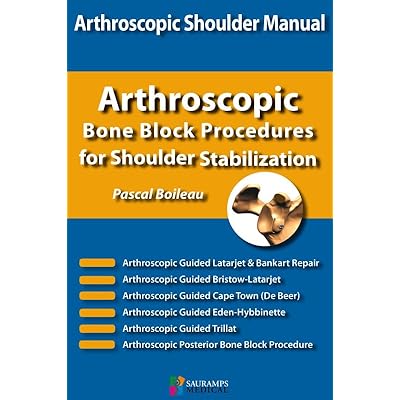 Arthrostopic Shoulder Manual: Arthrostopic Bone Block Procedures for Shoulder Stabilization: COLL NICE SHOULDER