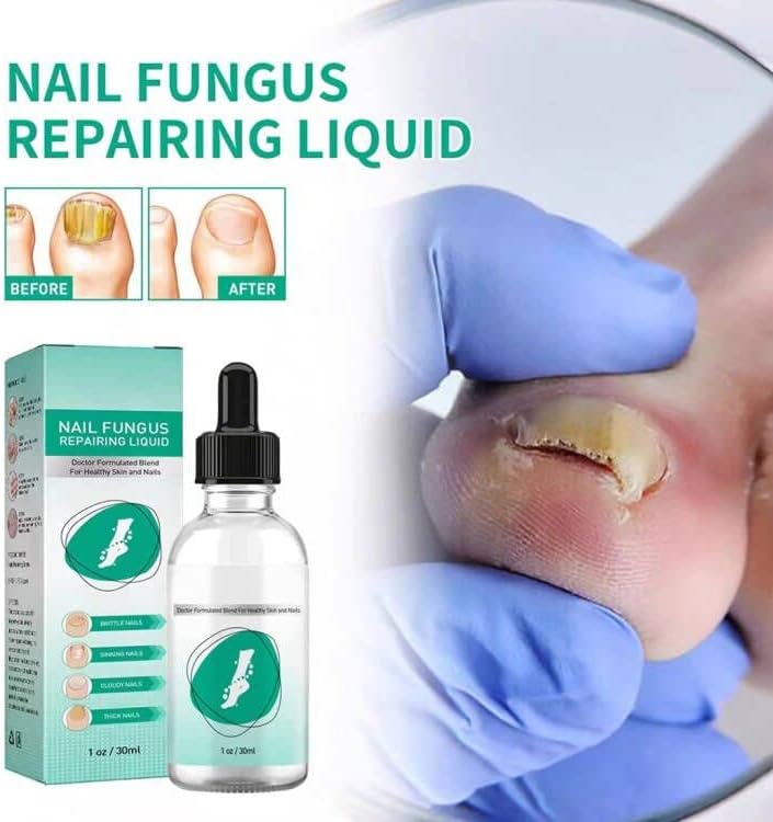 Kerassentials Toenail Fungus Treatment Oil , Best Repair Solution for Fingernails and Toenails , Fix & Renew Damage Fungal Nail, Broken, Cracked & Discolored Nails