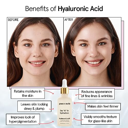 Image of grace & stella Award Winning Hyaluronic Acid Serum (10ml /0.34 fl oz) Hyaluronic Acid Serum for Face - Acido Hialuronico Face Serums for Women - Hydrating, Remove Fine Lines, Wrinkles - Anti Aging