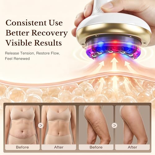 Rechargeable Cellulite Remover with Heat