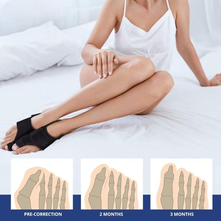 Image of Bunion Corrector for Women and Men Toe Separator One Feet Bunion Splint, Big Toes Separation Pain Relief, Non-Surgical Adjustable Hallux Valgus Bunions Thumb Straightener, Hammer Toe Day Night Support (1 Bunion Corrector + 1 Toe Separator)
