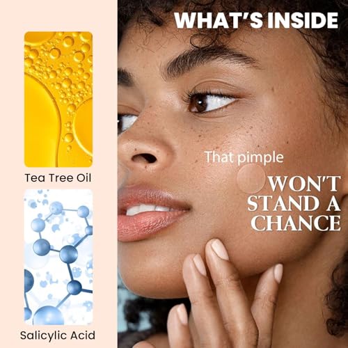 Image of WILDGLOW Korean Hydrocolloid Overnight Acne Pimple Patch | Heal Pimples, Absorbs Pus-Oil, Reduces Redness | Enriched with 2% Salicylic Acid, Tea Tree Oil & Glycolic Acid | All Skin Types | 36 Patches