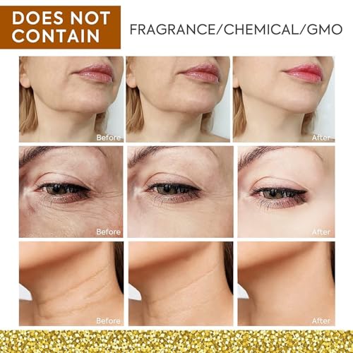 Neck Firming Cream: Anti-Aging neck cream for tightening and firming - Best Neck Tightening Cream For Fine lines, Loose & Sagging Skin On Face, Neck, Décolleté (1.7Oz) - Image 7