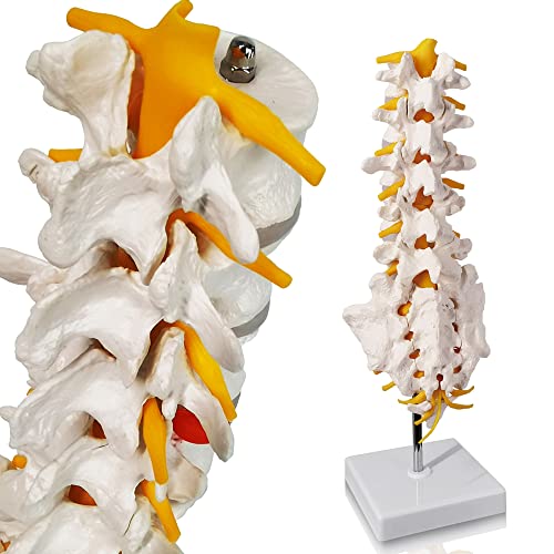 Image of EVOTECH SCIENTIFIC Lumbar Spine Anatomy Model with Sacrum and Spinal Nerves, Didactic Replica of Lumbosacral Section with Nerves and A Herniated Disc At L4, Includes Base for Medical Teaching Display