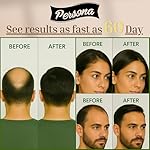 Hair Growth Serum – Advanced Biotin with Caffeine, Peptides, Botanical Extract for Thicker, Fuller, Longer Hair, Reduces Hair Thinning, Hair Regrowth Tonic, Hair Loss Treatment for Men & Women, 30ml - Image 5