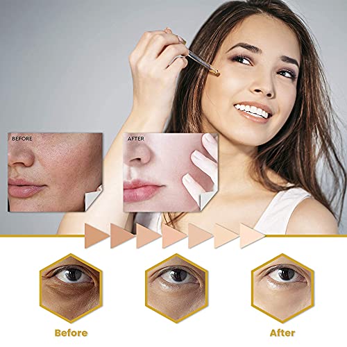 Lightenup, Skin Brightening Serum - 1 Fl Oz / 30 Ml - Dark Spots Corrector For Face, Armpits, Hands, Knees And Body, With Argan Oil And Shea Butter #TOP4