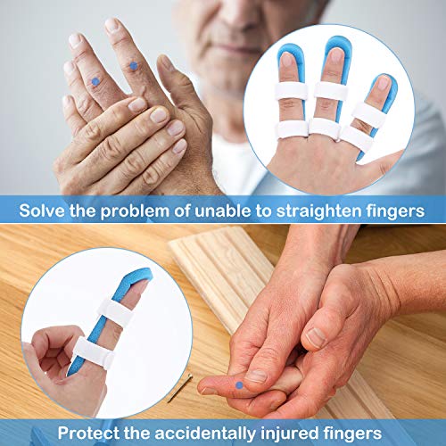 10 Pieces Finger Splint Metal Finger Support Finger Knuckle Immobilization With Soft Foam Inner Band And Protective Vent For Adults And Children, 3 Sizes (Blue) #TOP1