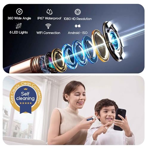 Image of Manimo Ear Cleaner Tool Kit with 1080p HD Wireless Camera & WiFi - Reusable Ear Wax Removal Tweezers, Portable Ear Cleaning Kit for Adults & Kids, Safe for Sensitive Skin - 12 Month Warranty