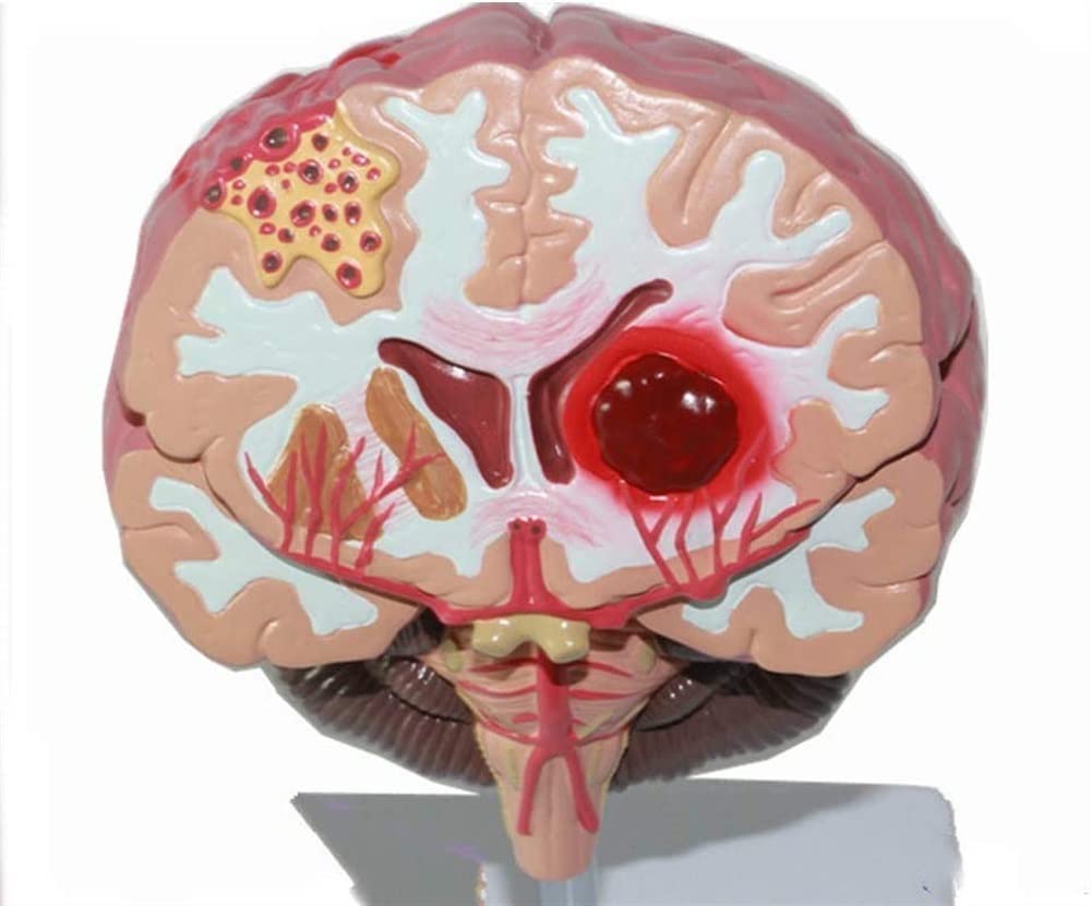 Tryb Nauczania Anatomii, Tryb Montażu Chorób Mózgu Ludzkiego, Tryb Anatomii Neurochirurgii, Tryb Nauczania Patologii Krwotoków Mózgowych