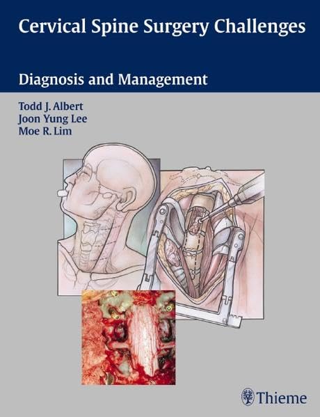Buy Cervical Spine Surgery Challenges: Diagnosis and Management — BookShops.in