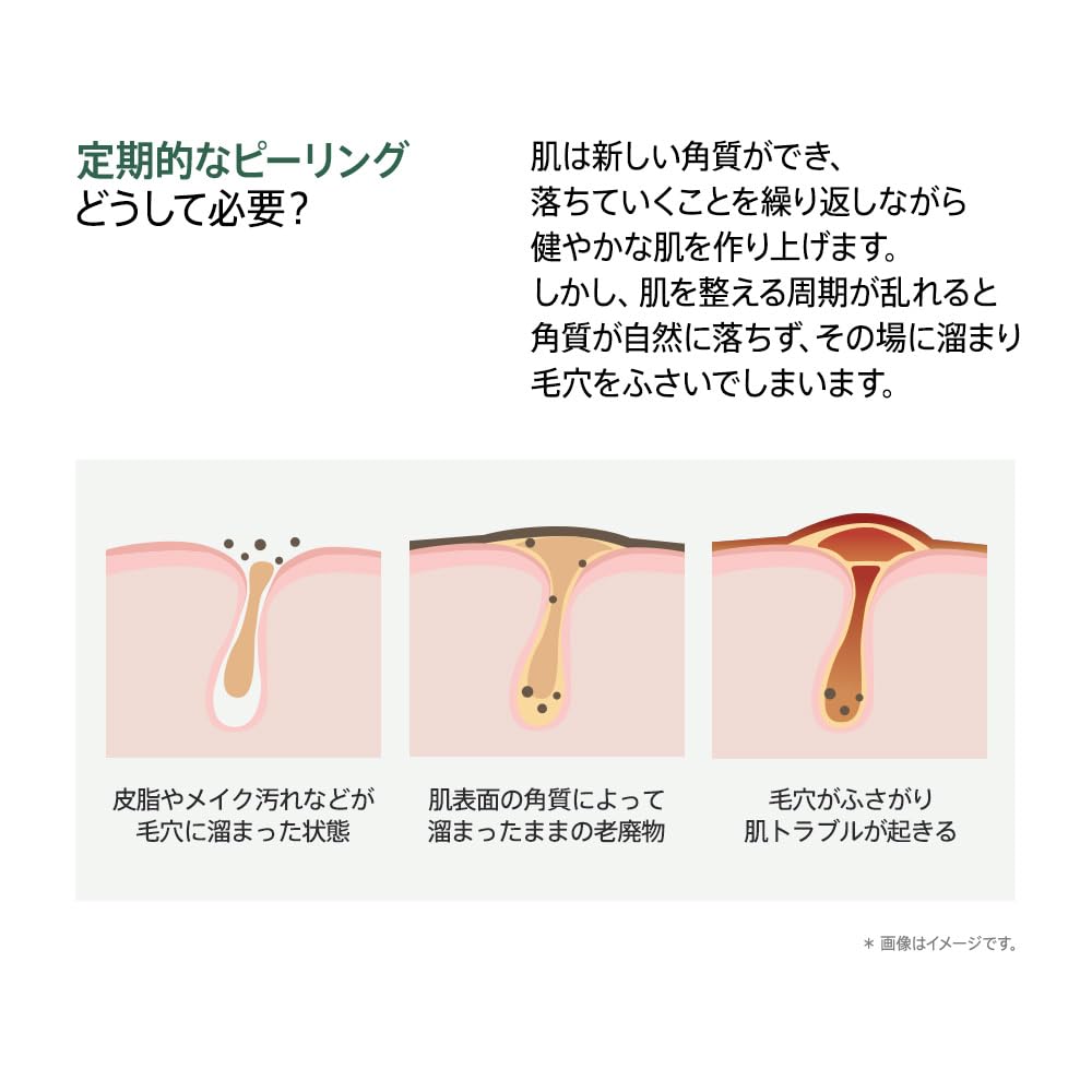 ANUAドクダミLHAモイスチャーピーリングジェルで肌を整える