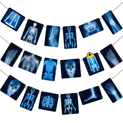Radiology X Ray Theme Banners Radiology Birthday Party Decorations X Ray Party Banner Garlands for Radiology Doctor Birthday Party X Ray Medical Theme Party Baby Shower Supplies