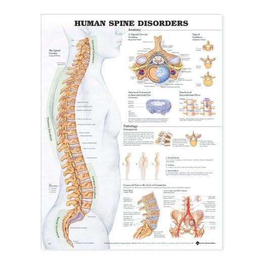 Gráfico anatómico de trastornos de la columna vertebral humana