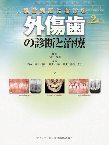 乳歯列期における外傷歯の診断と治療 第2版