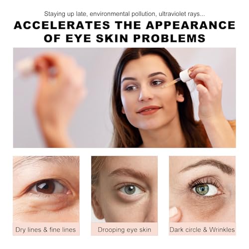 Soro de Olho de Retinóides, Loção de Soro de Retinóides Redutor de Rugas Desvanece-se Olheiras 30ml