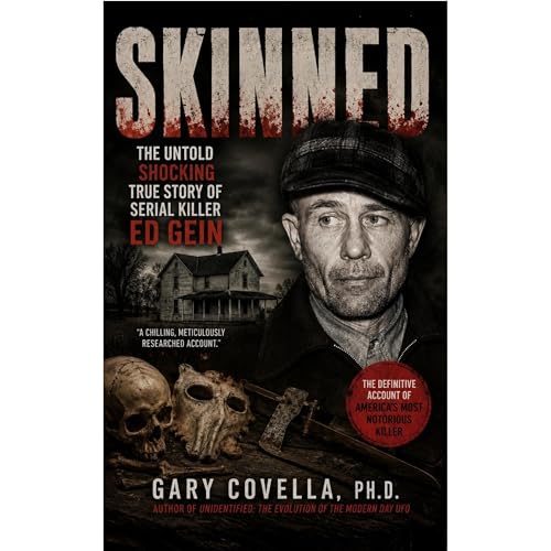 Skinned Audiobook By Gary Covella cover art
