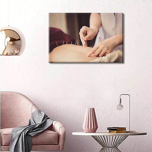 Image of Wall Painting Acupuncture and Moxibustion Paintings for Wall Decorations 1 Panels Physical Therapists do Acupuncture Wall Art Giclee Wooden Framed Gallery-Wrapped Ready to Hang (12 inch Wx18 H)