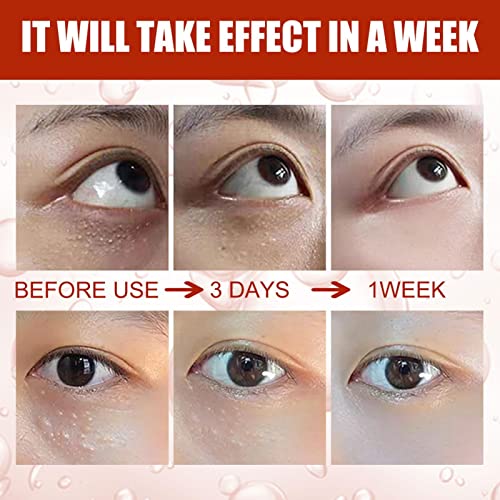 Essência do olho para olheiras,Óleo essencial facial para olheiras | Elimine o embotamento dos olhos