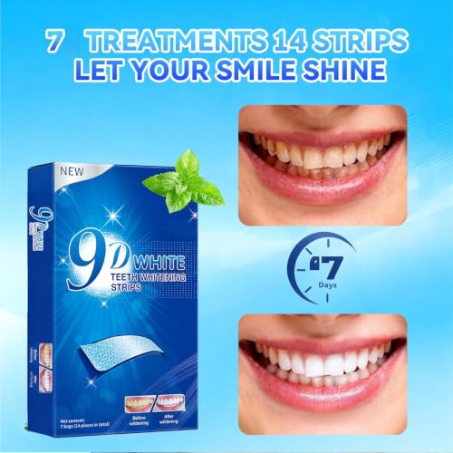 Image of Teeth-Whitening Strips for Sensitive Teeth - 9D Teeth Whitening Kit Professional Effects, Teeth Whitener for Enamel Safe, 14 White Strips (7 Day Treatment) Remove Stains for a Brighter Smile, Mint