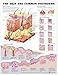 Produktbild Skin and Common Disorders Anatomical Chart