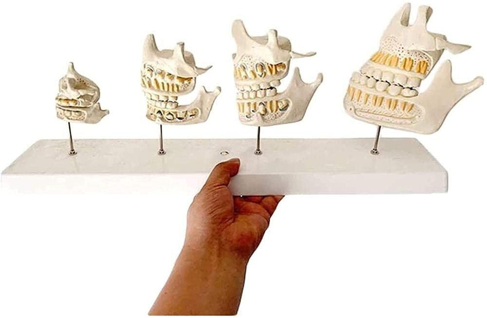 Modèle parodontale de croissance dentaire NaoSIn-Ni, anatomie médicale de haute précision