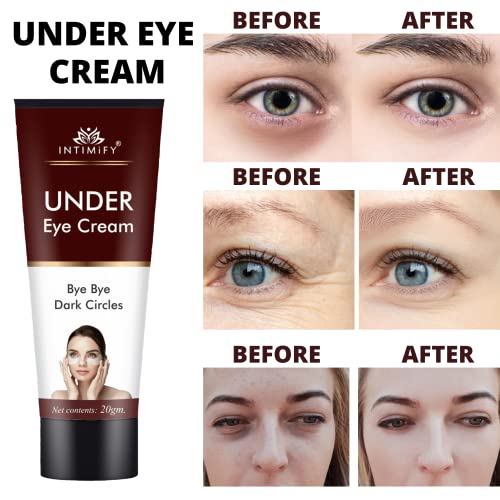 Image of INTIMIFY Under Eye Cream For Dark Circles For Women & Men, Dark Circle Remover Cream With Shea Butter 20g