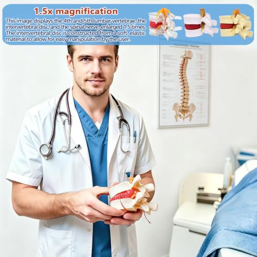 Image of Human Anatomical Lumbar Herniation Model with Nerve Root,Anatomical Vertebrae Model for Education,Excellent Way for Demonstrating Disc(Yellow)