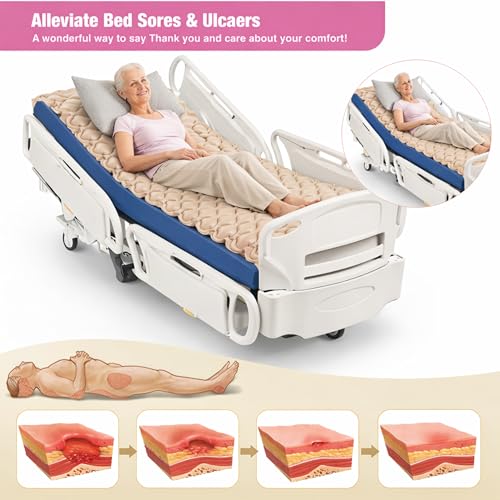 Image of AMKAY Anti-Decubitus Bubble Air Mattress with Electric Pump for Bedsore Prevention - Alternating Pressure Medical Grade Bubble Pad for Patients, Alpha Bed Mattress, Beige - 1 Year Replacement Warranty