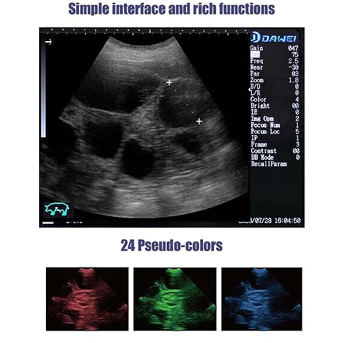 Dawei SAMPLE_SKU_19016 S1 Veterinary Ultrasound Machine thumb #5
