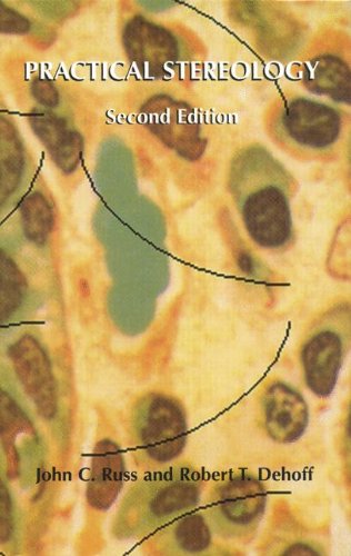 Practical Stereology