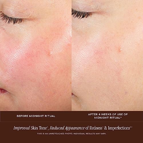 Summer Fridays Midnight Ritual Retinol Serum - Renewal Retinol Serum for Face, Fine Lines & Discoloration - Enriched with Jojoba Oil, Hyaluronic Acid & Niacinamide to Smooth Uneven Texture (1 oz) - Thumbnail 6
