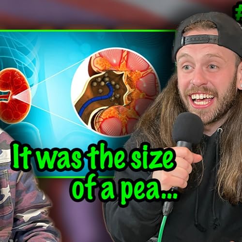 He Passed a Kidney Stone by Jerking Off?! (Ep43)