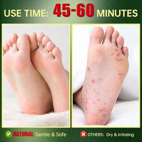 Foot Peeling Mask, Natural Exfoliating Foot Mask, Dead Skin Callus Remover Repair Heels, Hydrating Foot Care for Dry Cracked Feet(3 PacK)