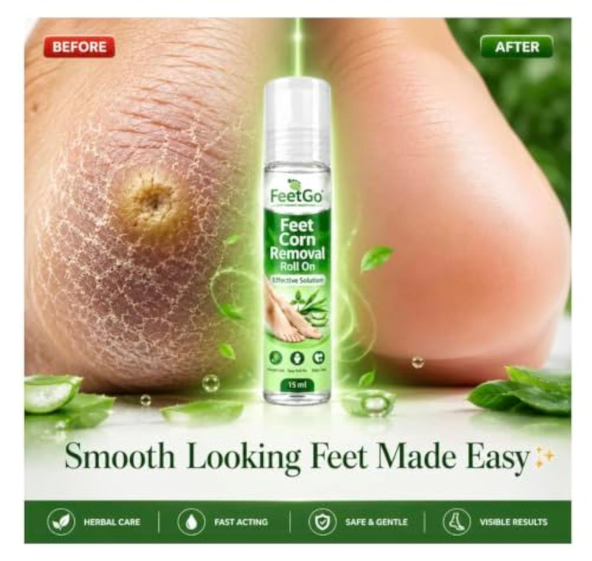 FeetGo Foot Corn Care Roll-On with Aloe Vera & Tea Tree