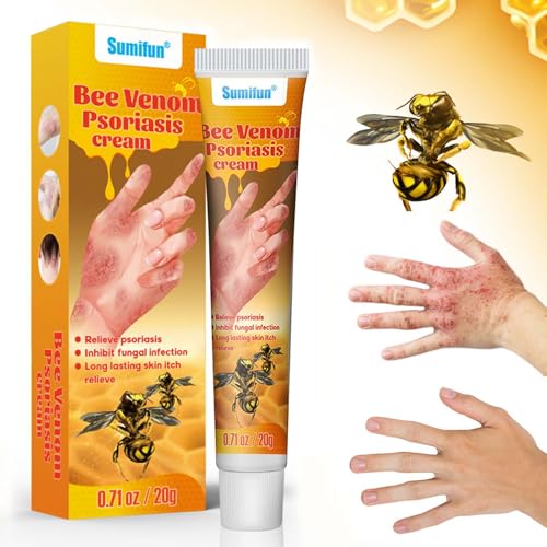 Crema de Tratamiento para la Psoriasis con Veneno de Abeja – Alivio Rápido y Refrescante para la Psoriasis, Crema de Veneno de Abeja para Alivio Eficaz de la Psoriasis