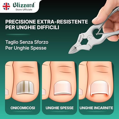 Blizzard Tagliaunghie Professionale - Tronchese Per Unghie Dei Piedi Spesse E Dure - Taglio Concavo - Doppia Molla - Manico Zigrinato - Ce Strumento Chirurgico Per Podologi - Fabbricato In Acciaio Inossidabile Tedesco 15 Cm - 2