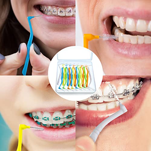 20 Pieces Interdental Brushes Braces Toothbrush Betweens Angle Alternative Brushes Flossing Head Oral Dental Tooth Brush Interdental Cleaners For Tooth Cleaning (Mixed Sizes, Mixed Colors) #TOP5