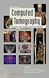 Computed Tomography: Fundamentals, System Technology, Image Quality, Applications