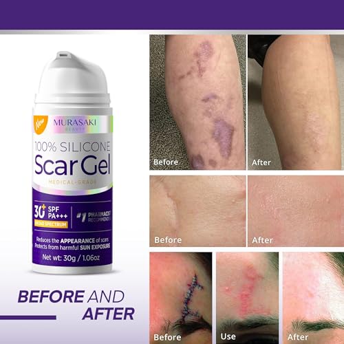 Image of Silicone Scar Gel Scar Cream: SPF 30 Advanced Medical-Grade Formula for Surgical Scars, C-Section, Stretch Marks, Acne, Burns, Keloids, Old & New Scars - Broad Spectrum UV Protection 1.06oz (30g)