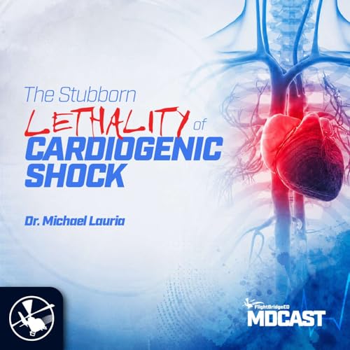 MDCAST: The Stubborn Lethality of Cardiogenic Shock