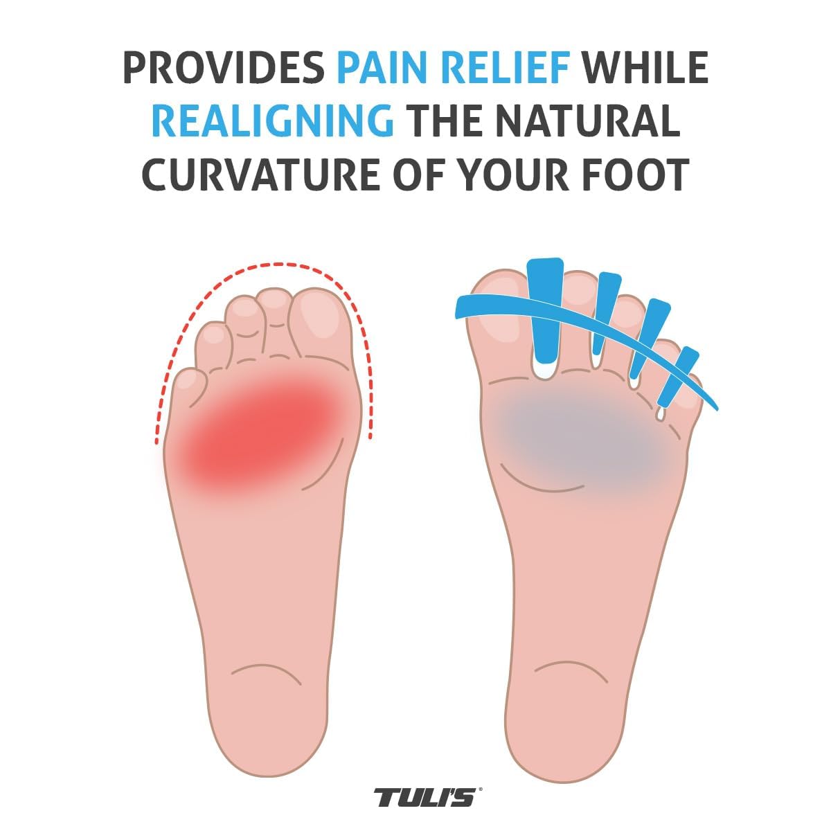 Tuli’s SoftMoves – Verstellbare Zehenspreizer zur Unterstützung der Ausrichtung, bei Hallux Valgus, Hammerzehen, Plantarfasziitis und Morton-Neurom, Einheitsgröße, Blau | Silikon-Zehenspreizer für Ballenzehen, Hammerzehen, Plantarfasziitis, Yoga, Morton-N