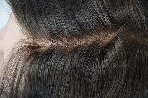 Image of SkyHair PU Diamond Coated Border MIRAGE Skin Base Undetectable Scalp PREMIUM Hair Patch for Men 100% Remy Human Silky and Soft Hair Wigs Highly Durable Mens Toupee can be Install with Clips, Glue or Tape (Natural Brown, 10x7, Medium Density)