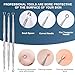 Professional Facial Blackhead Remover Tools,6-Piece Stainless Steel Acne Extractor Tools Set with Storage CaseKit for Whitehead Acne Blemishes Comedones Stainless Steel Makeup Tool