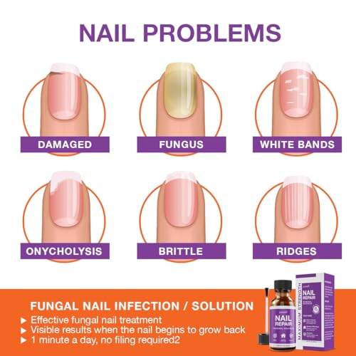 Toenail Fungus Treatment Extra Strength: Nail Fungus Treatment for Toenails and Fingernail for Damaged Discoloration Nails 1Oz - Image 3