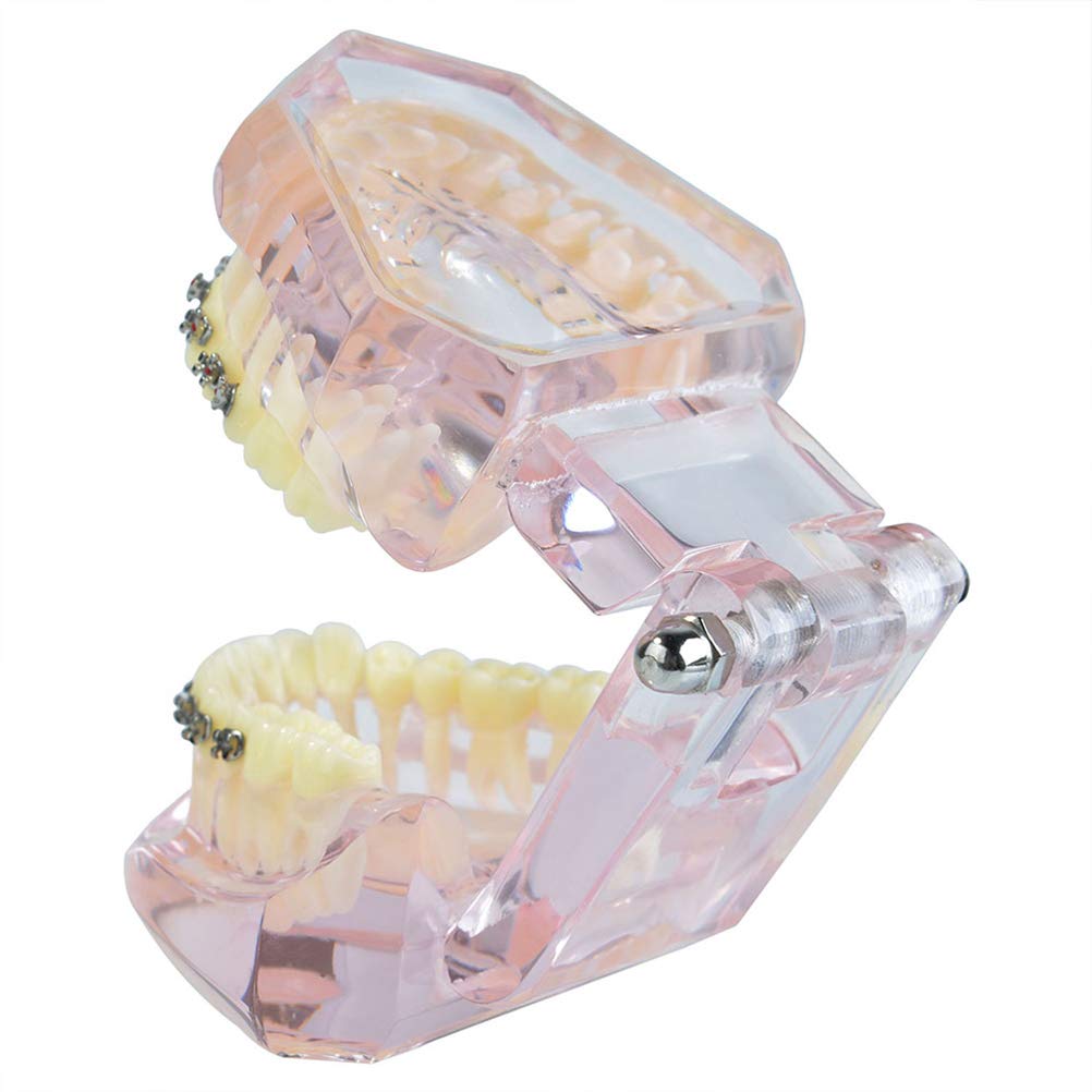 Typodont Dentaire Standard Adulte Pour étude Orthodontique - Modèle Démonstration Neuf