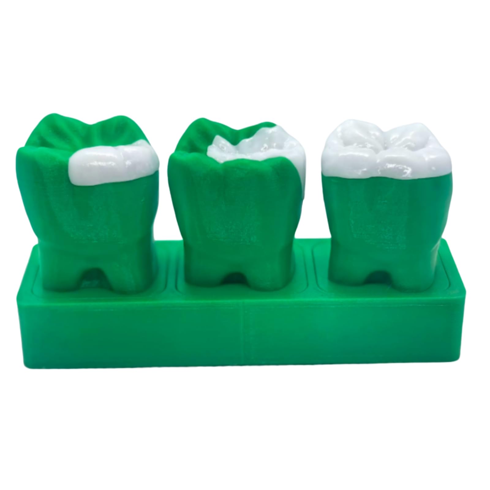 YRQMGSF 6X Teeth Model Inlay Display Model,Dental Teeth Care Model,Dentistry, High Inlays, Gifts for Dentists,Grey
