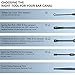 Hion 8 Pcs Ear Wax Removal Kit,Professional Double-Headed Ear Pick Earwax Removal Tools,316L Stainless Steel Ear Cleaner Curette with Cleaning Brush and Storage Box,Suit for Kid Adult(Black)